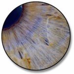 Iridologia